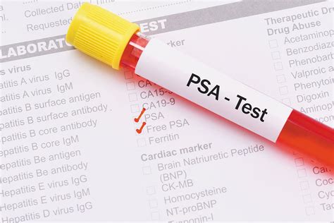 alcohol and psa test|PSA test .